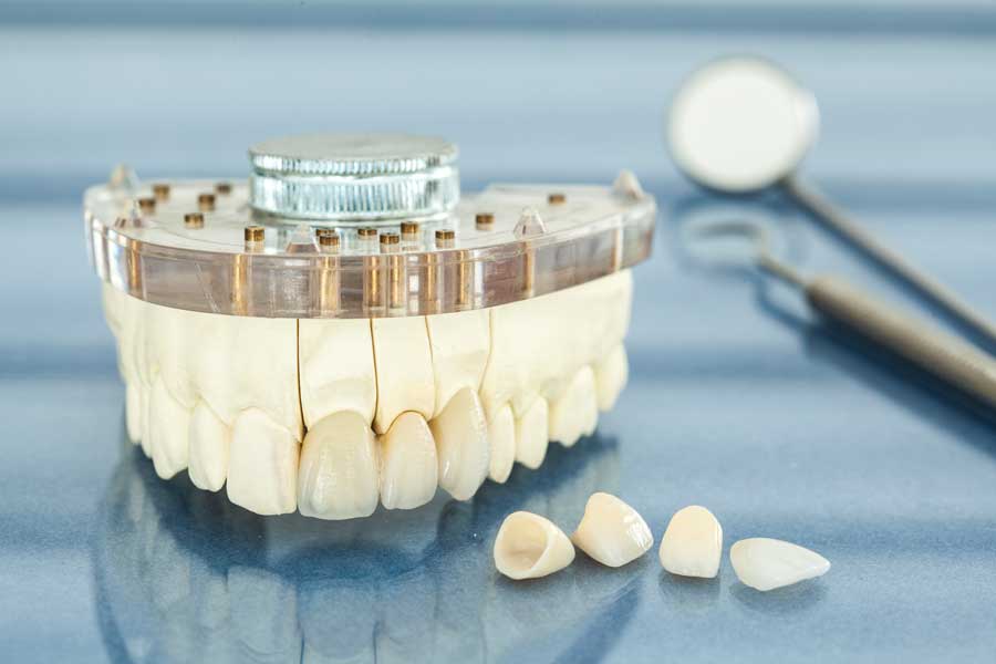 Porcelain Dental Crown Houston TX | Metal Dental Crown - Richmond Dental PLLC