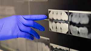 MetLife Dental PPO providers