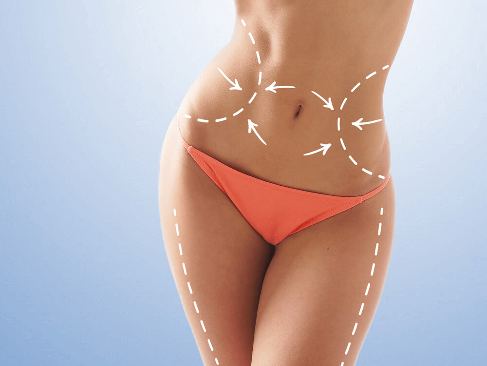 Liposculpture vs. Liposuction Houston, TX | Liposuction For Men | Premiere Surgical Arts