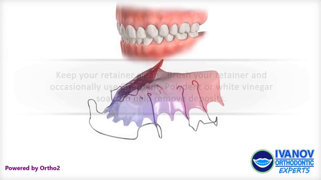 Invisalign Dental Care
