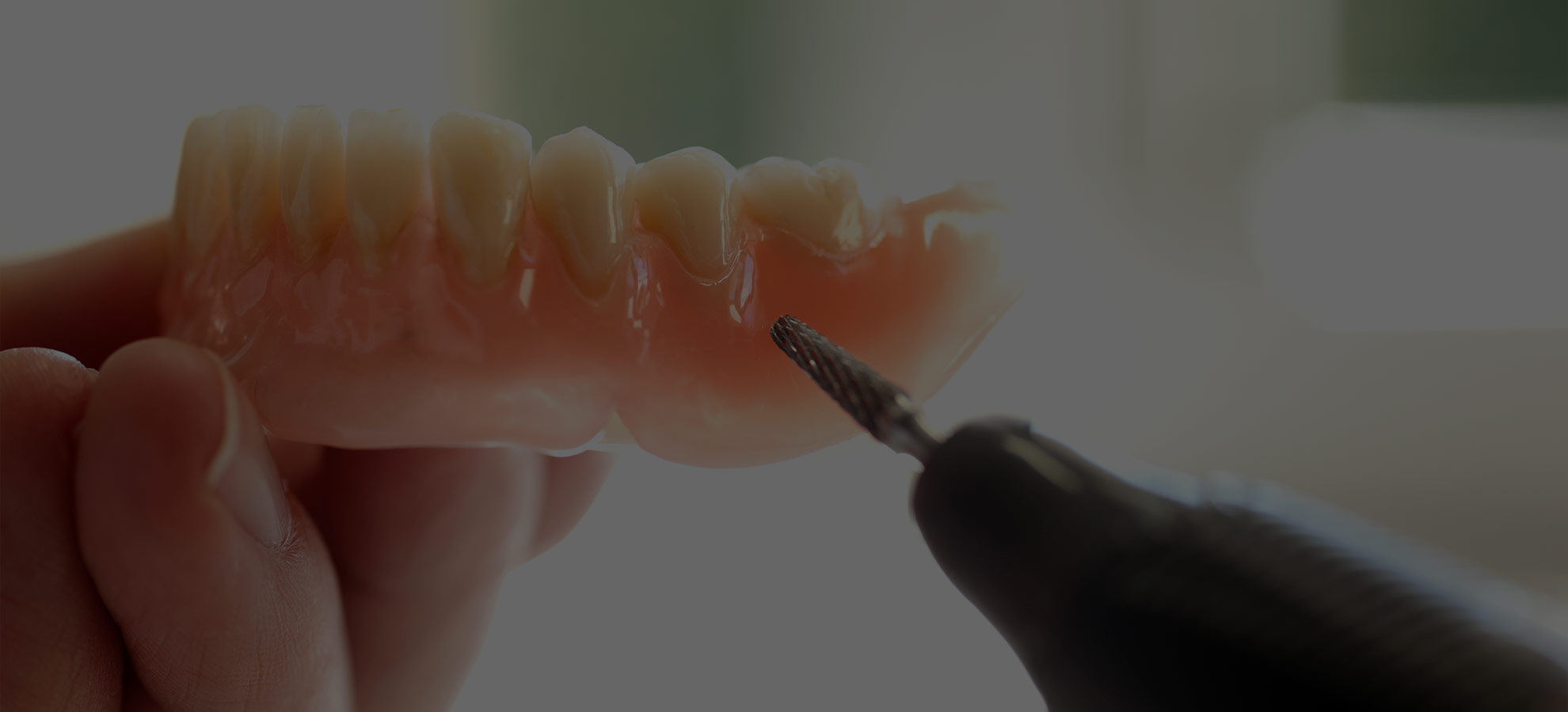 ADVANTAGES OF COMPOSITE TOOTH FILLINGS - flackflores