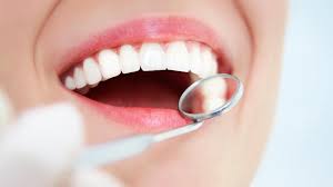 How To Improve Smile With Dental Crowns? » Emergencydentalclinic