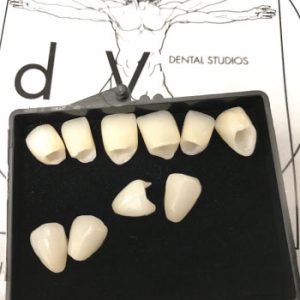 Dental Crown &Bridges Houston TX | Dental Crowns Procedure Near Me