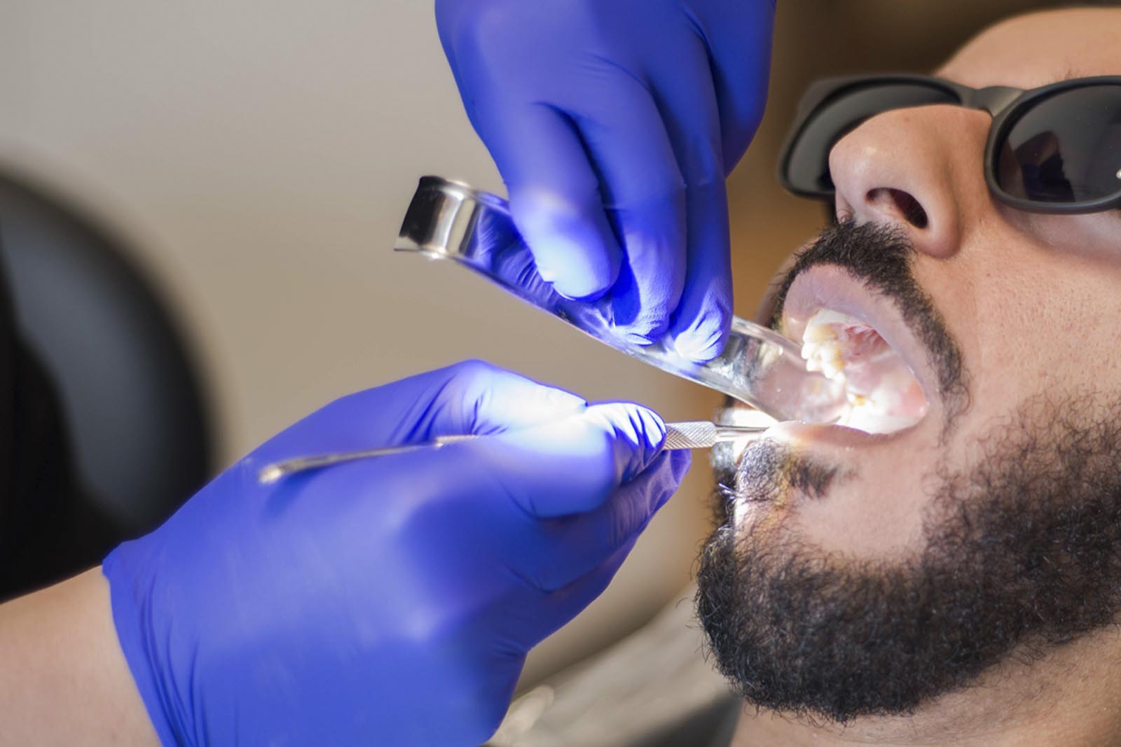 Why Is Root Canal Treatment More Preferable To Both Dentists And Patients? - ezequielvince